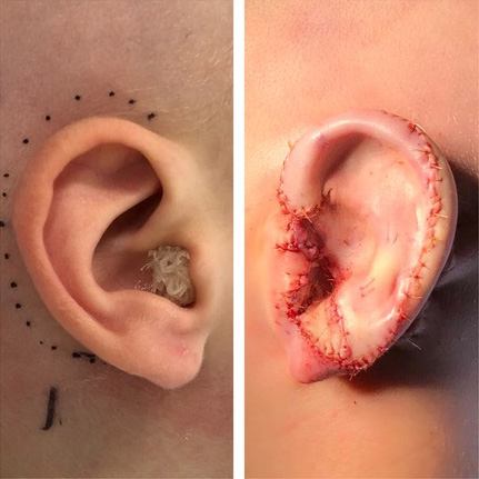 Ear